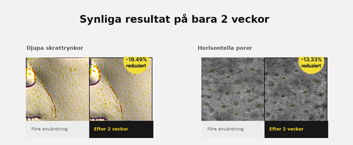 Celimax™ | Fasthetsserum med retinal