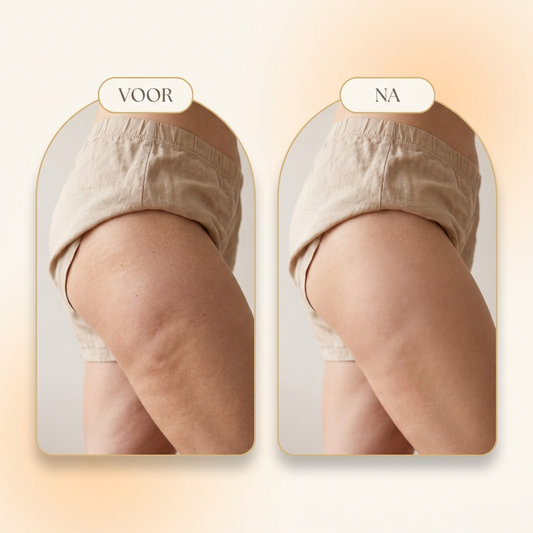 Celluvia™ | Cuppingverktyg med värme och massage