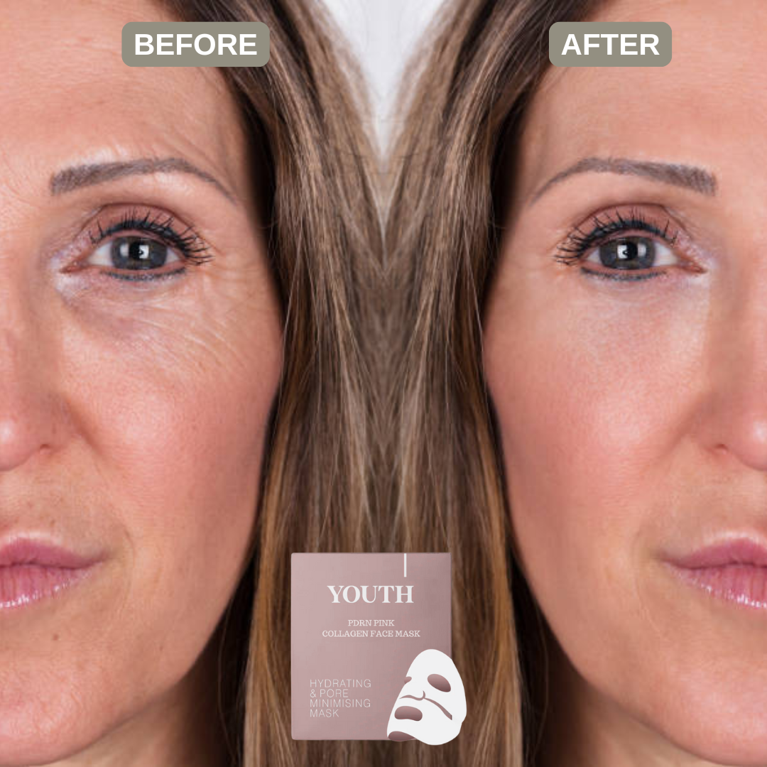 Pinkaura™ | PDRN-hydrogelmask med kollagen