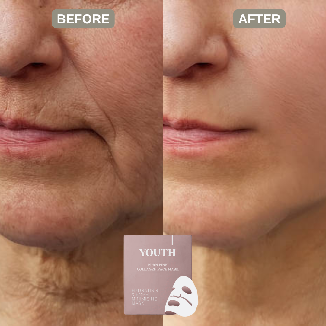 Pinkaura™ | PDRN-hydrogelmask med kollagen