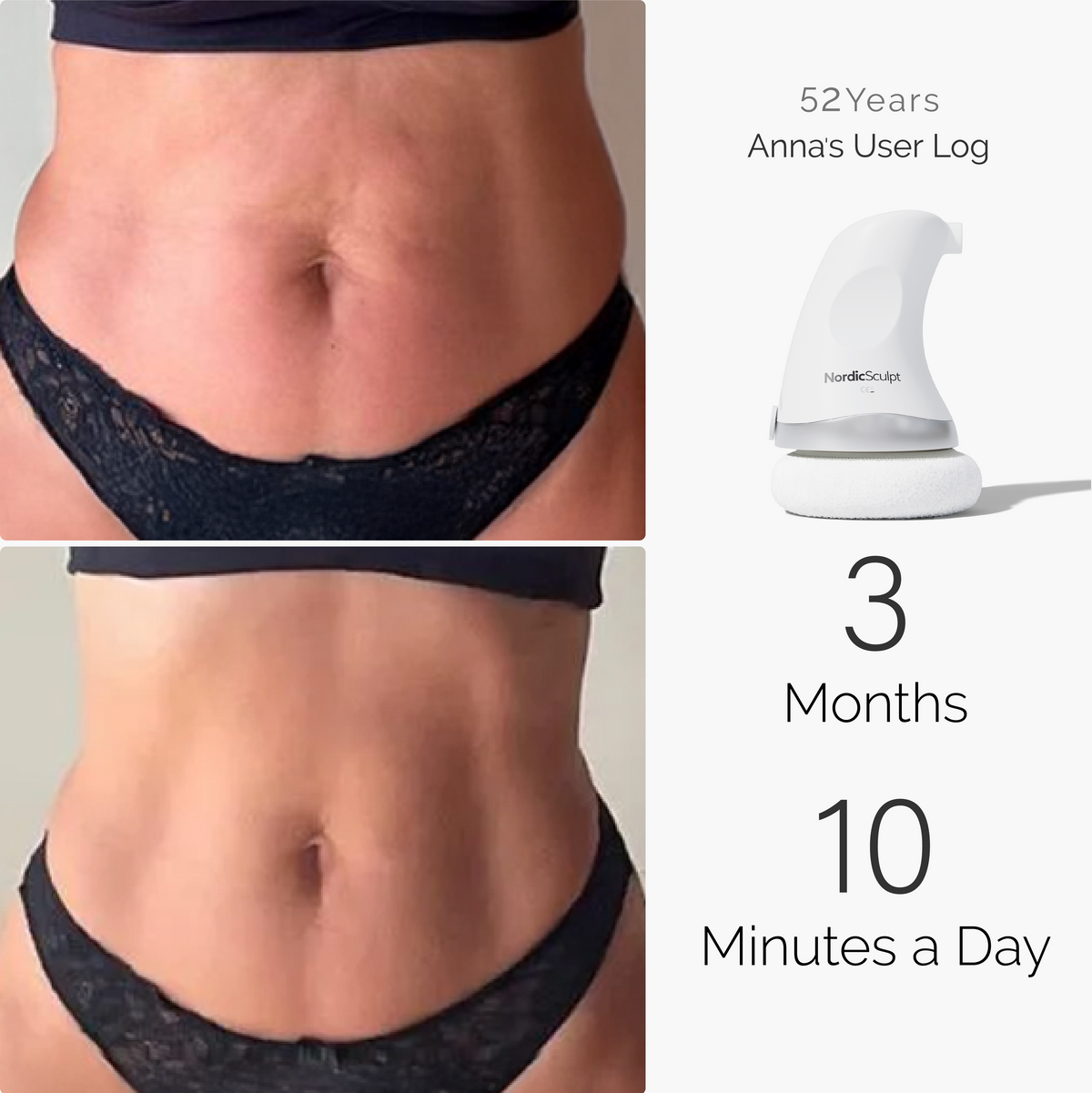 Velora Body™ | Kroppsmassagerare för hudens fasthet